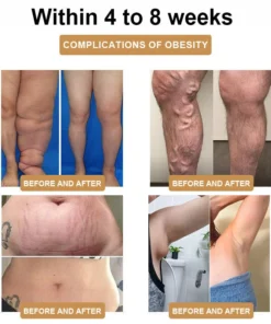 SlimPulse™ Ultrasonic Fat Blasting and Detoxing Wristband