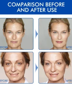 Tiworld™ Botox Stock Solution Facial Serum with Vitamin C & E