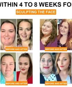 ZVLZVL™ Bee Venom Lymphatic Drainage Slimming Patch