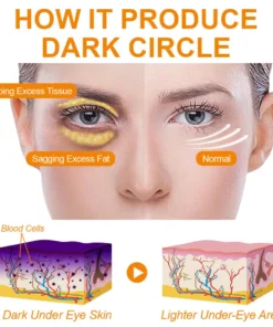 flysmus™ Rejuvenating Bee Venom Eye Lifting Gel