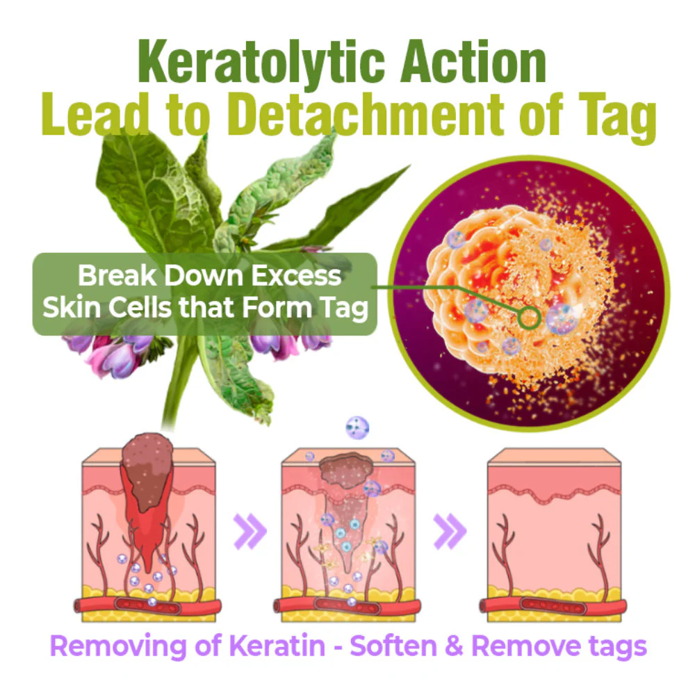 flysmus™ TagOff Comfrey Herbal Treatment Serum - Image 3