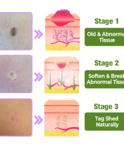 flysmus™ TagOff Comfrey Herbal Treatment Serum