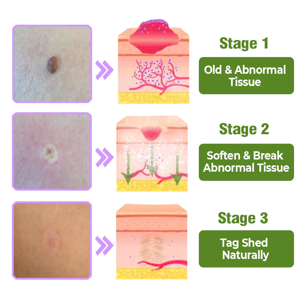 flysmus™ TagOff Comfrey Herbal Treatment Serum