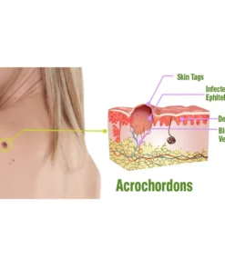 flysmus™ TagOff Comfrey Herbal Treatment Serum