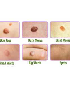 flysmus™ TagOff Comfrey Herbal Treatment Serum