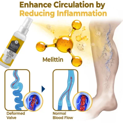 flysmus™ Varico-X Vein Dredge Bee Venom Spray