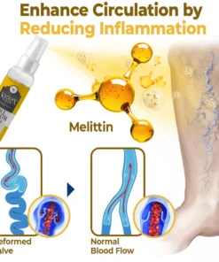 flysmus™ VaricoX Vein Dredge Bee Venom Spray