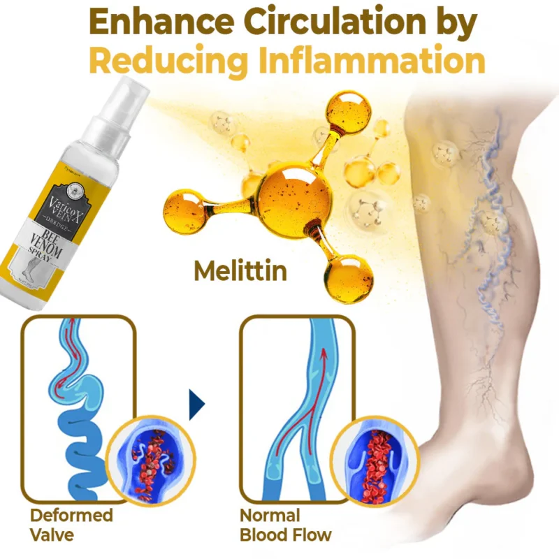 flysmus™ VaricoX Vein Dredge Bee Venom Spray