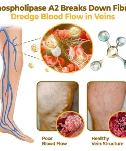 flysmus™ VaricoX Vein Dredge Bee Venom Spray