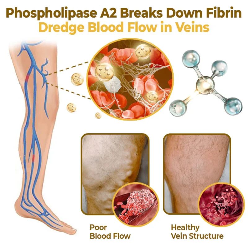 flysmus™ VaricoX Vein Dredge Bee Venom Spray