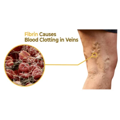 flysmus™ VaricoX Vein Dredge Bee Venom Spray