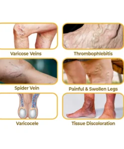 flysmus™ VaricoX Vein Dredge Bee Venom Spray