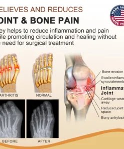 𝐓𝐎𝐃𝐀𝐇𝐎𝐅™ 𝐁𝐞𝐞 𝐕𝐞𝐧𝐨𝐦 𝐀𝐫𝐭𝐡𝐫𝐢𝐭𝐢𝐬 𝐓𝐫𝐞𝐚𝐭𝐦𝐞𝐧𝐭 𝐒𝐩𝐫𝐚𝐲