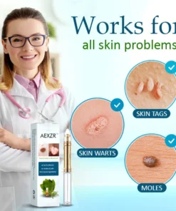 AEXZR™ Tag & Mole Remover