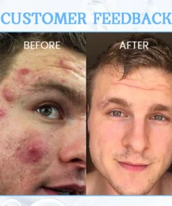 AQA™ PoreClear 2% BHA Skin Renewal Liquid