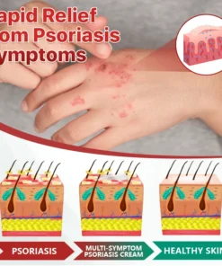 Biancat™ Bee Venom Psoriasis Relief Cream