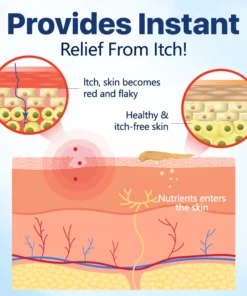 Biancat™ EaseItch Genital Soothing Cream