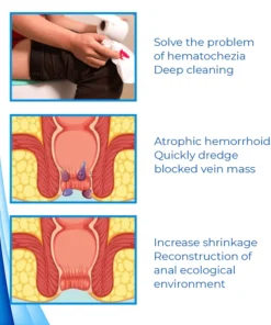 Biancat™ HemoEase Herbal Hemorrhoid Relief Cream