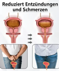 Biancat™ ProstaPower Magnetisches Handgelenkband