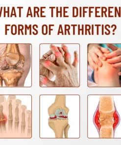 Spray de teràpia calmant d'os Ceoerty™ amb cúrcuma