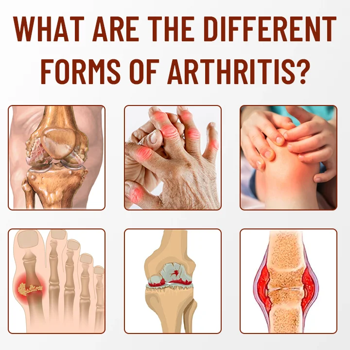 Spray de teràpia calmant d'os Ceoerty™ amb cúrcuma