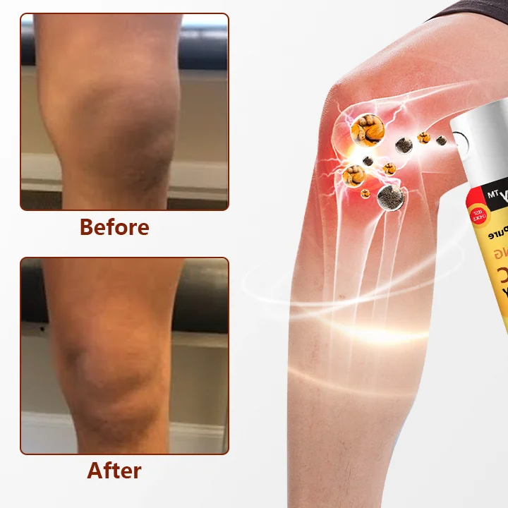 Spray de teràpia calmant d'os Ceoerty™ amb cúrcuma