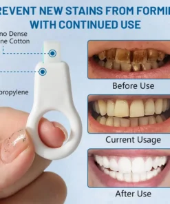 Ceoerty™ Highly effective tooth stain cleaner