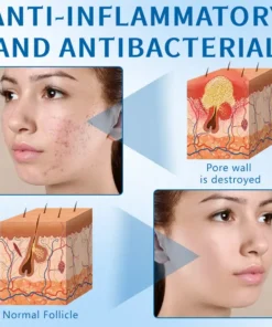 Ceoerty™ Vitamin B5 Salicylic Acid Cleansing Gel Mask