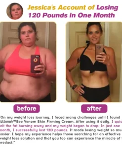EdiJonah™ Bee Venom Skin Firming Cream
