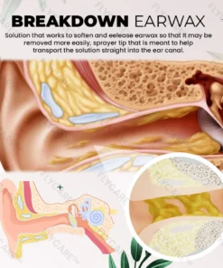 FLYCARE™ Anti Cochlear Blockage Removal Spray