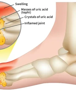 FLYCARE™ Bee Venom Advanced Joint and Bone Therapy Cream