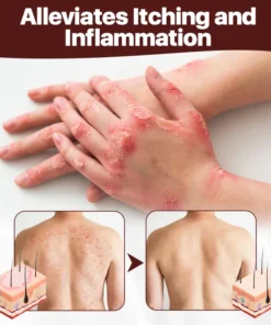 FLYCARE™ Cow's Fart Eczema Essence