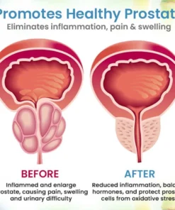 FLYCARE™ Detox Prostate Wellness Foot Pads