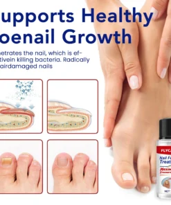 FLYCARE™ Nail Fungus Treatment Serum