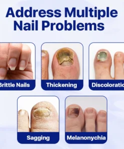 FLYCARE™ Nail Fungus Treatment Serum