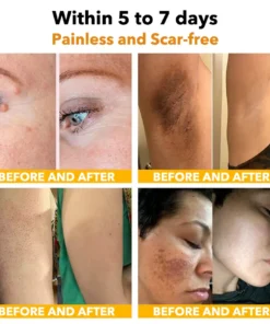 Furzero™ Bee Venom Therapy Spray