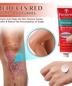 Furzero™ Psoriasis Anti-Itch Treatment Lotion