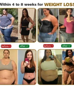 Furzero™ SlimEase Bee Venom Lymphatic Drainage Slimming Patch