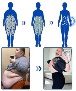 GFOUK™ Slenderfast Lymphatic Graphene Bracelet