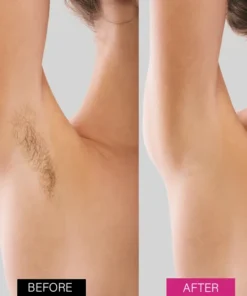 GlowNest™ BeeSilk Hair Removal Mousse