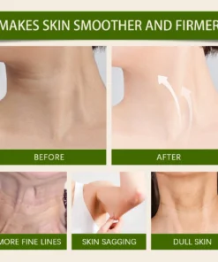 HZA™ Tightens skin and restores skin elasticity