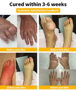 LOVILDSโข ๐๐๐ ๐๐๐ง๐จ๐ฆ ๐๐๐ฏ๐๐ง๐๐๐ ๐๐จ๐ข๐ง๐ญ ๐๐ง๐ ๐๐จ๐ง๐ ๐๐ก๐๐ซ๐๐ฉ๐ฒ ๐๐ซ๐๐๐ฆ