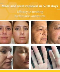 LOVILDS™ TagCure Bee Venom Wart & Moles Removal Cream