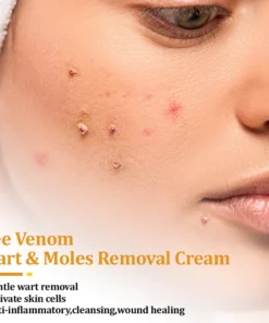 LOVILDS™ TagCure Bee Venom Wart & Moles Removal Cream