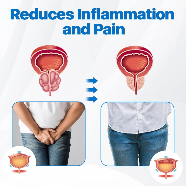 ODEIUN™ ProstaPower Magnetic Copper Band