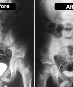 Oveallgo™ TitaniumMag Prostate Wellness Bracelet