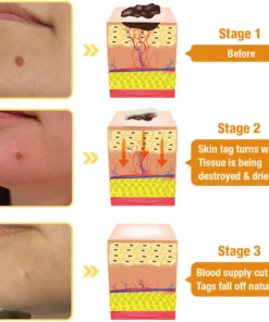 flysmus™ TagRecede Bee Venom Spray