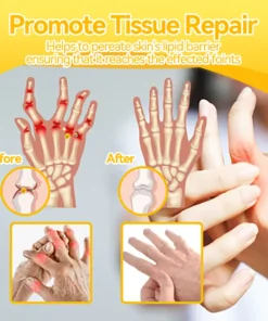 𝐒𝐩𝐳𝐯™ 𝐁𝐞𝐞 𝐕𝐞𝐧𝐨𝐦 𝐉𝐨𝐢𝐧𝐭 𝐚𝐧𝐝 𝐁𝐨𝐧𝐞 𝐓𝐡𝐞𝐫𝐚𝐩𝐲 𝐂𝐫𝐞𝐚𝐦