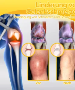 𝐒𝐩𝐳𝐯™ 𝑩𝒊𝒆𝒏𝒆𝒏𝒈𝒊𝒇𝒕𝑪𝒓𝒆𝒎𝒆 𝒛𝒖𝒓 𝑩𝒆𝒉𝒂𝒏𝒅𝒍𝒖𝒏𝒈 𝒗𝒐𝒏 𝑮𝒆𝒍𝒆𝒏𝒌𝒆𝒏 𝒖𝒏𝒅 𝑲𝒏𝒐𝒄𝒉𝒆𝒏