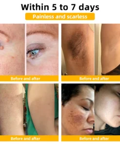 𝑇𝑢𝑟𝑜𝑛𝑢™ Bee Venom Skin Treatment Cream